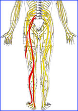 back pain, lifting heavy boxes