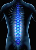 Spinal Cord Injury Dallas