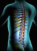 spinal cord injury help in dallas Fort worth